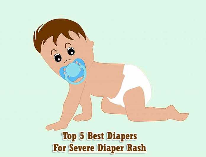 best diapers for severe diaper rash