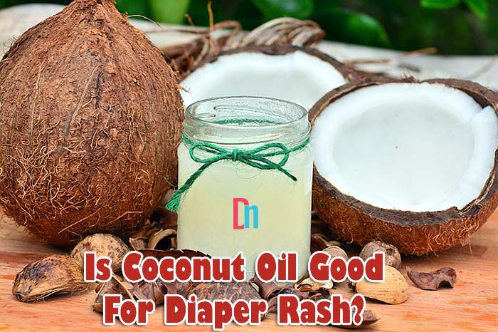 Is Coconut Oil Good For Diaper Rash? Is Coconut Oil Good For Diaper Rash?