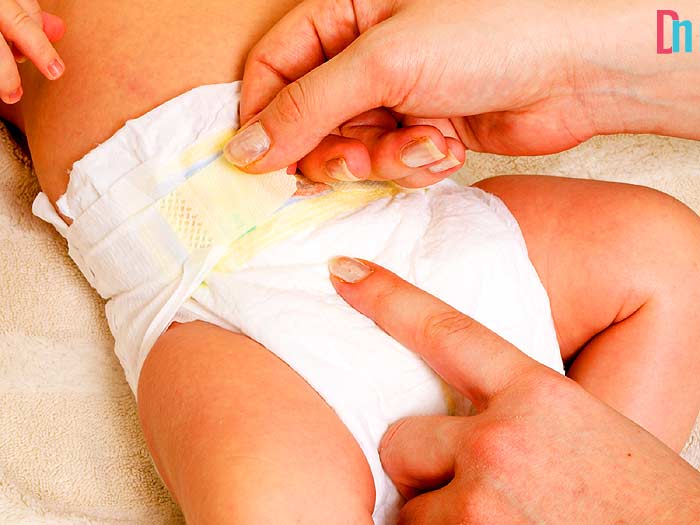 What to look for in wipes for diaper rash?